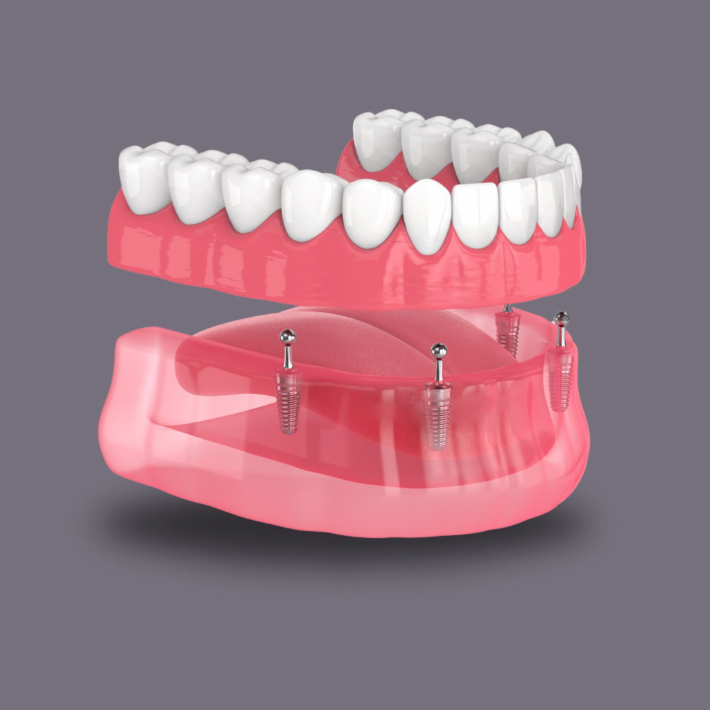 Dentures images