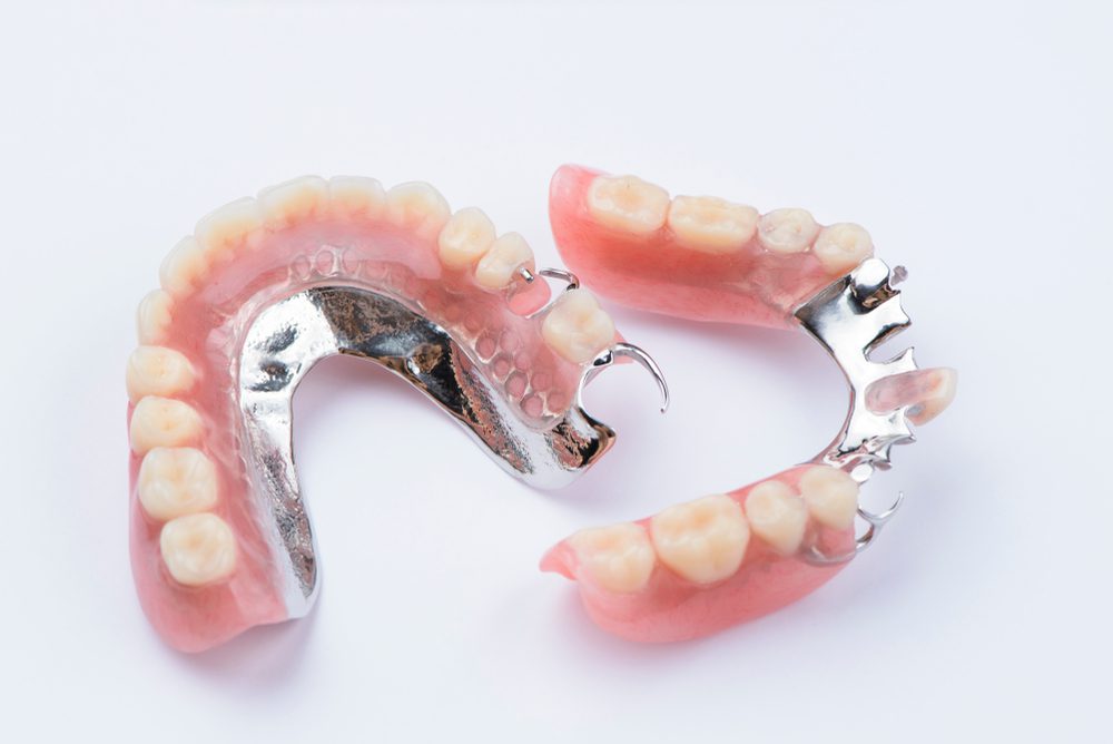 Partial Dentures - Sunrisedental Chatswood